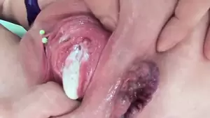 anal nasty - NASTY ANAL SLUTS COMPILATION â€“ GAPED ASSHOLE PROLAPSED | xHamster