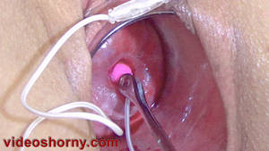 Extreme Catheter Porn - Uterus Inflation with Catheter and Cervix Penetration with Vibrator and  Objects
