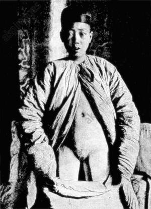 Eunuch Porn Asian Boy - A Young Eunuch undressed to show his castration, Beijing 1901 [1000x728px]  : r/HistoryPorn