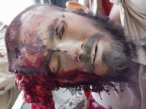 Gross Disgusting Porn - Woops, a tank rolled over this guys head. That is what you are doing to  your brain when you view porn.