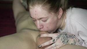 Acne Teen - acne XXX Movies | iXXX