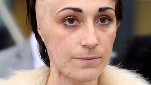 Asian Schoolgirl Sex Porn - Acid attack survivor writes book to help spot signs of abusive relationship  - ITV News