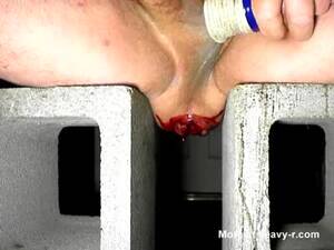 bleed ass anal - Anal Bleeding Videos - Free Porn Videos