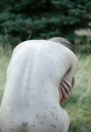 Leann Rimes Naked Porn - LeAnn Rimes reveals psoriasis flare-up in powerful photo shoot