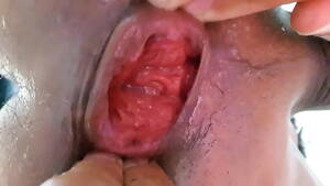 Extreme Anal Gay Porn - gay anal extreme - XVIDEOS.COM