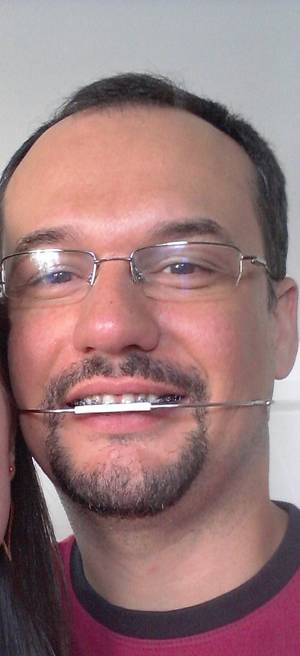 Braces Headgear Porn - The consummate geek look: glasses & braces, enhanced by cervical headgear.