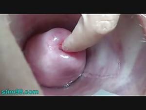 extreme uterus insertion hentai - 