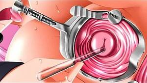 extreme anal insertion anime syringe - Extreme Anal Insertion Anime Syringe | Sex Pictures Pass