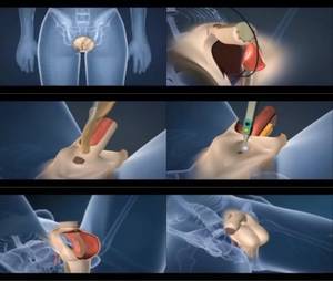 Male Transformation Porn - female to male transformation porn.swf