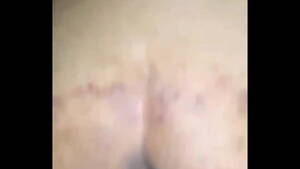 bruised ebony ass - Bruised ass - XNXX.COM