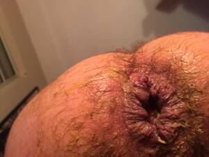 loose mature anal - loose anal gape | MOTHERLESS.COM â„¢