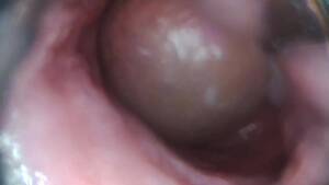 Cum Inside Pussy Camera - Endoscope: REAL Camera INSIDE Pussy CUM V1 - ThisVid.com