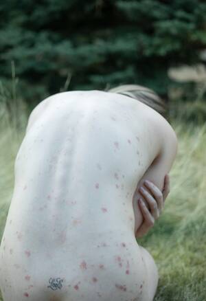 leann rimes nude upskirt - LeAnn Rimes reveals psoriasis flare-up in powerful photo shoot