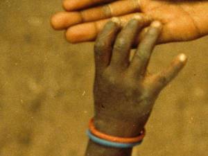 Genital Mutilation Death Note Porn - Everything you need to know about female genital mutilation