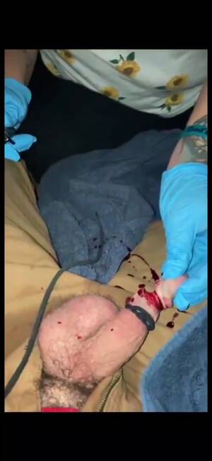 Cock Cut Off - CrazyShit.com | Woman cuts the tip of her penis with a knife. - Crazy Shit