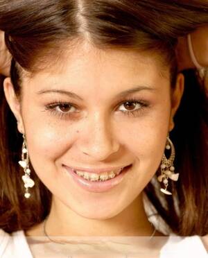 natural tits braces - Braces Face Porn Pics & MILF Sex Photos - IdealMilf.com