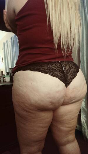 fat stretch marks - Ass Bent Over Stretch Marks