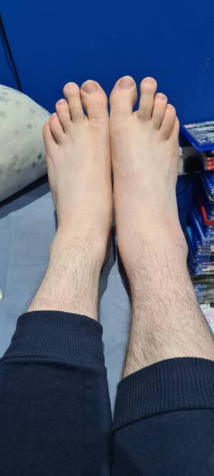 foot heel bruise - Update on my ankle from yesterday's post. I got it xrayed just in case, no  breaks or fractures but it's very swollen and bruised : r/NewSkaters