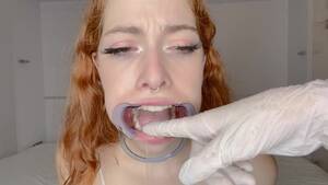 Mouth Dental - Open Mouth Dentist Porn Videos | Pornhub.com