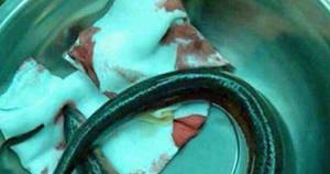 Eel Porn - Porn addict has emergency surgery to remove live EEL he inserted up his  backside to copy x-rated film - Mirror Online