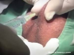 Male Castration Porn - Scary Castration Video