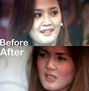 Denise Cornejo Sex Scandal - Showbiz in a snap: Deniece Cornejo gave Vhong Navarro a blowjob on their  first date, and other news | Coconuts