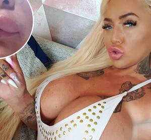 Botox Lips Porn - Adult star enhancing her 'porn look' nearly died when Â£300 fillers caused  severe reaction | The Sun