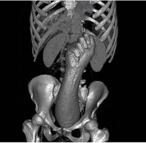 3d X Ray Porn - Literally X-ray porn : r/XRayPorn