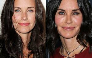 Courteney Cox Celebrity Porn - Plastic Surgery Before and After Pics: Courteney Cox, JWoww, and More  Celebrities