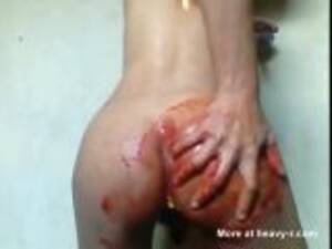 ass ripped - Asshole Ripped Open And Bloody Videos - Free Porn Videos