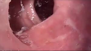 internal asshole - Girl Anal Endoscope Rectum Camera inside - ThisVid.com