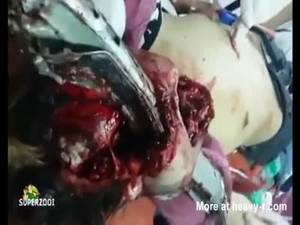 Erotic Anime Snuff Porn - Young Woman Impaled By Metal Rail