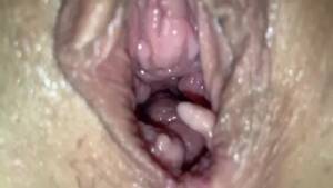 Anal Belly Bulging Fisting - Princess gets fisted with belly bulge - Free Porn Videos - YouPorn