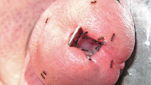 ants sucking dick - ants in dick - Formicophilia | MOTHERLESS.COM â„¢