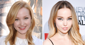 Dove Cameron Anal Porn - Dove Cameron's Tranformation: 'Shameless' to 'Descendants' to Now