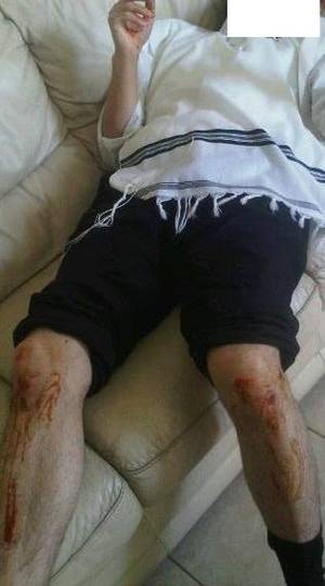 Hasidic Jewish Women Porn - Ultra Orthodox Jews nearly kill Gur man.