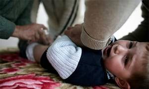 Genital Mutilation Death Note Porn - A Muslim boy cries as a doctor performs a circumcision on him