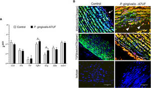 chen guan xi - Frontiers | Differential affinity chromatography reveals a link between  Porphyromonas gingivalisâ€“induced changes in vascular smooth muscle cell  differentiation and the type 9 secretion system