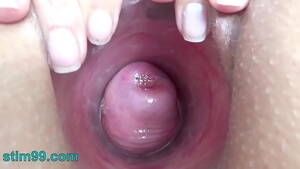 Cervix Porn - Extreme Cervix Electrosex with sound depth into Womb - XVIDEOS.COM