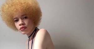 Albino African Porn - Diandra Forrest Is The Albino African American Model Who Proves Beauty  Isn't Black And