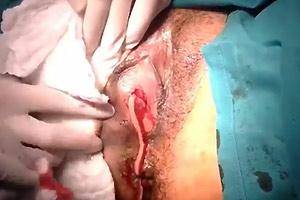 Medusa Tattoo Vagina Porn - Pus Pussy