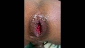 Black Gay Anal Fisting - Black Fisting Gay Porn Videos | Pornhub.com