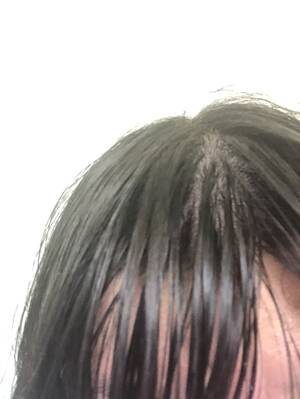 Greasy Hair Oily Messy Porn - Greasy Hair Oily Messy Porn | Sex Pictures Pass