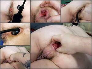 bbw anal slave - Vaginal Fisting Porn Videos | Inflatable Toy - BBW Anal Slave Rosebutt Anal  During Fisting And Inflatable Dildo Fully