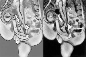 Mri Porn - cdn.arstechnica.net/wp-content/uploads/2019/12/Cou...