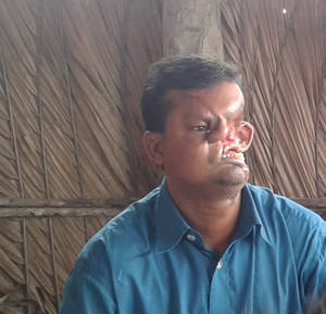 Disfigured Guy Porn - Hashmot Ali, 40, reveals his horrific disfigurement for the first time