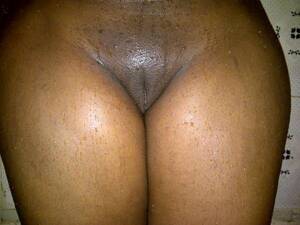 circumcised black pussies - Voluntary Circumcised Pussy