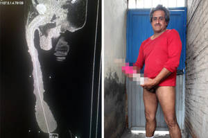 Mans World Porn Captions - Man with world's longest penis says he wants to be a porn star | Daily Star