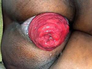 Black Prolapse Porn - Prolapse Porn | Booty Ebony Wife Show Her Huge Anal Prolapse - Release June  24, 2017