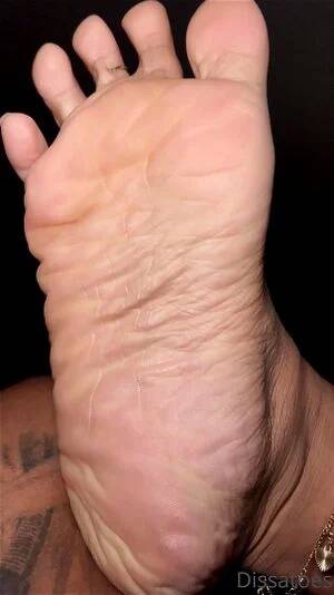 foot heel bruise - Watch Bdhduybrkshgdh - Krbdhifkr, Hrbdc8Dscuysdctuygscudngt, Solo Porn -  SpankBang
